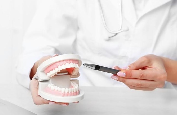 Dentures or Dental Implants